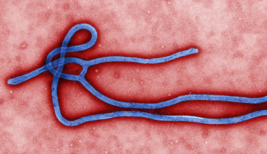 警惕最新病毒病人，你需要了解這些關(guān)鍵信息！