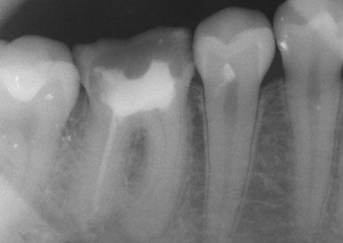 中國再生牙齒研究新進展，重塑微笑，科技引領(lǐng)牙齒再生新篇章