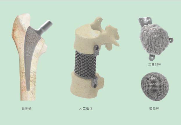 三維打印髖關(guān)節(jié)技術(shù)新動(dòng)態(tài)，重塑生活的科技魔法奇跡