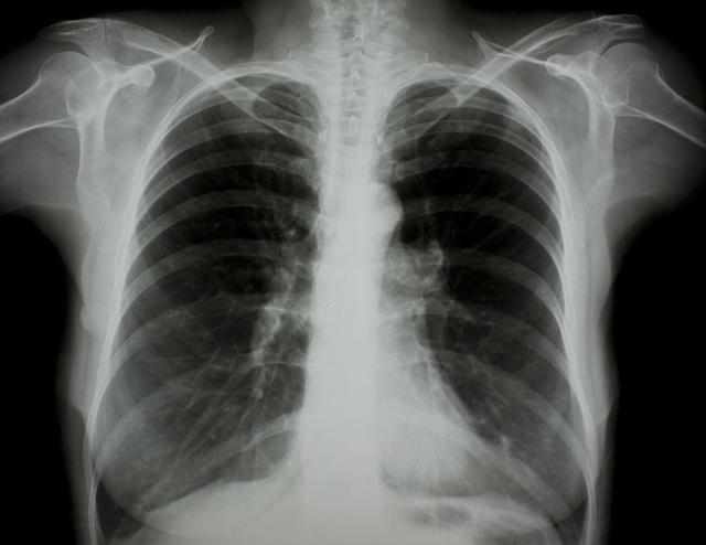 撫順?lè)窝鬃钚聞?dòng)態(tài)與全面步驟指南