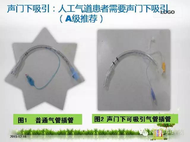 科技重塑急救，最新氣管插管視頻，體驗(yàn)未來醫(yī)療的魅力