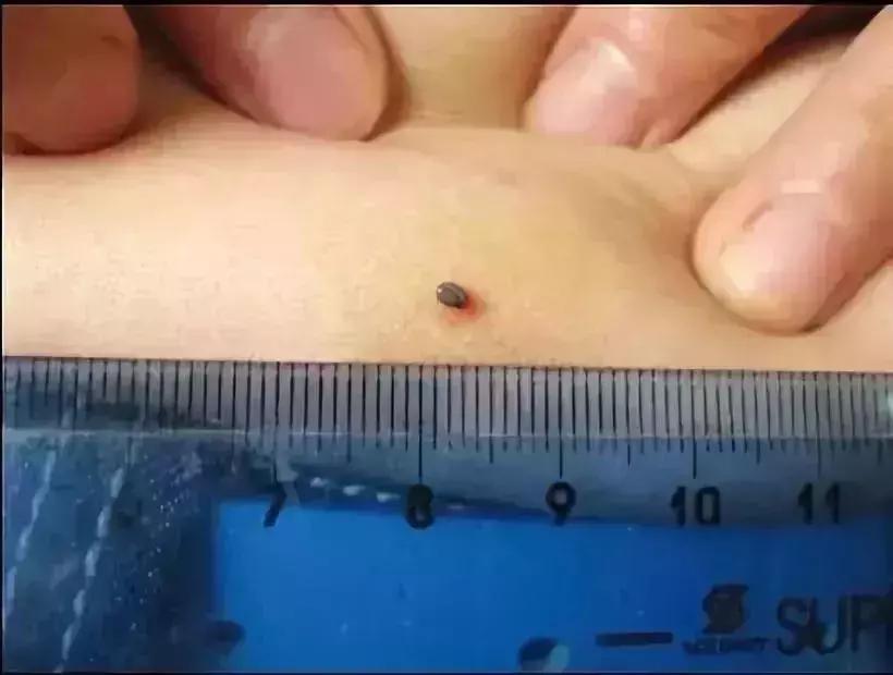 小明快樂(lè)疫情日志，最新疫情發(fā)布與日常觀(guān)察