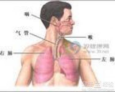 咸豐肺炎最新全面指南與詳解，癥狀、治療、步驟解析