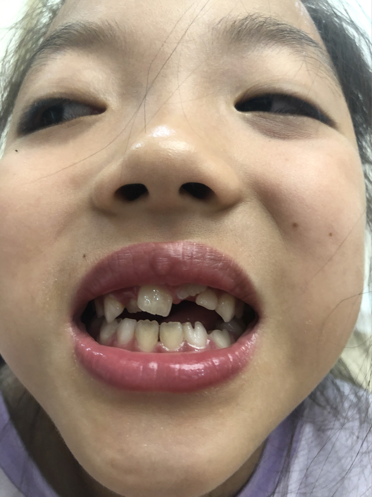 莊最新牙齒技術(shù)揭秘，牙齒美容新選擇