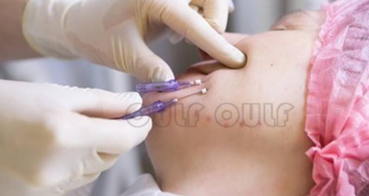 線雕最新手法，背景、發(fā)展、時(shí)代地位及展望